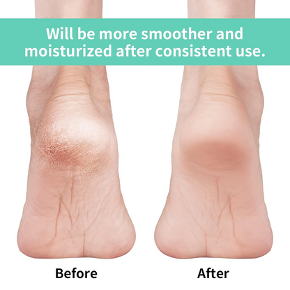 Infographic illustrating key features of the anti-crack silicone heel socks.